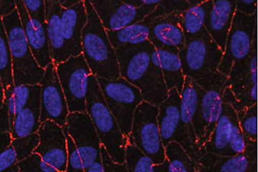 RPE cells